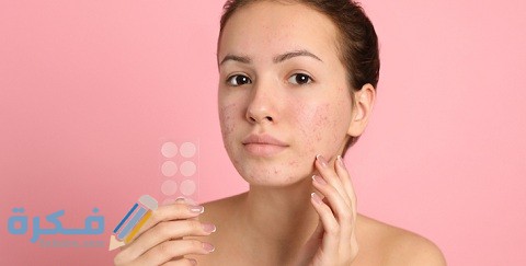 أفضل لصقات حب الشباب