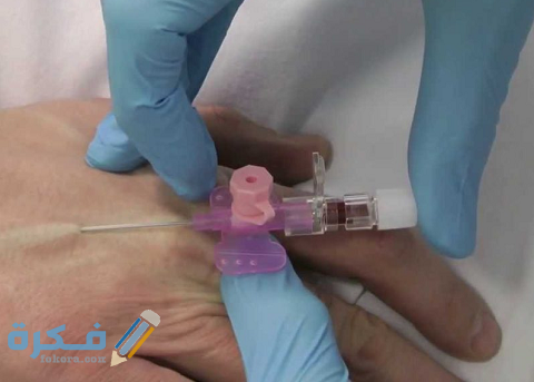 طريقة تركيب الكانيولا بالصور