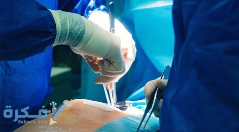 كيف تجرى عملية القلب المفتوح للأطفال