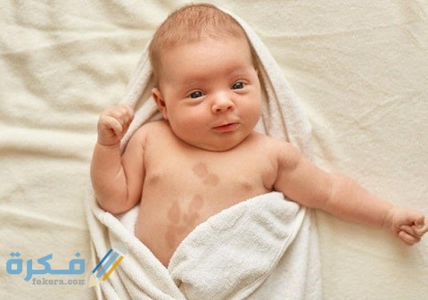 ما أسباب ظهور بقع بنية على جلد الرضيع