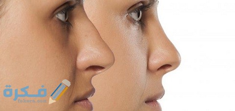 هل عملية تجميل الانف حرام