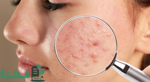 tbl articles article 28079 89441f53540 987e 4e58 a1d6 60b003efdc95