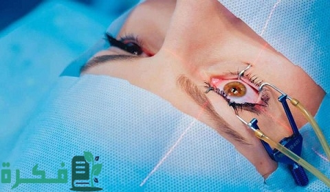 متى يستقر النظر بعد عملية الليزر السطحي