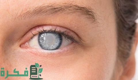 متى يستقر النظر بعد عملية المياه الزرقاء