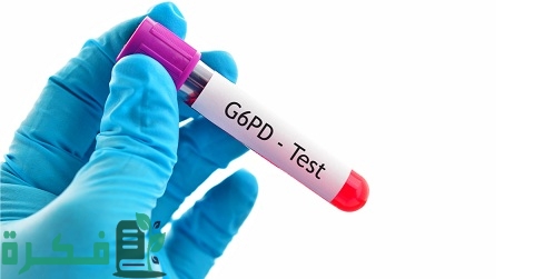 ما هو تحليل G6PD
