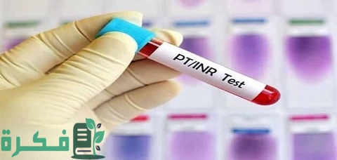ما هو تحليل INR