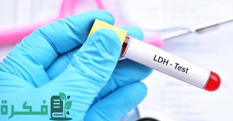 ما هو تحليل LDH