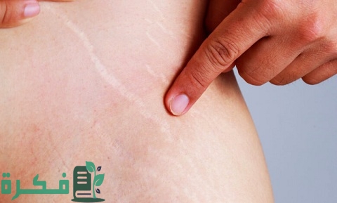 ما هي تقنية الكاموفلاج