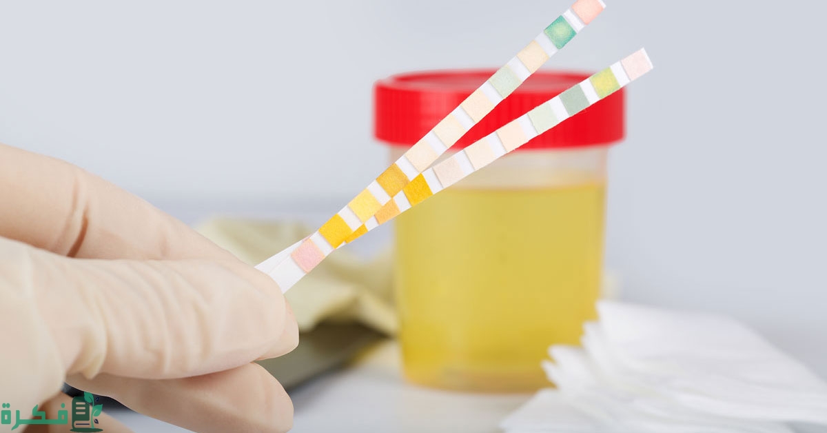 ما هو علاج اصفرار البول 4 tbl articles article 21234 3521200c25d 90c4 4f16 88b4 031ff39d97ec