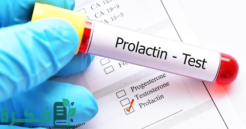 ما هو تحليل Prolactin للرجال