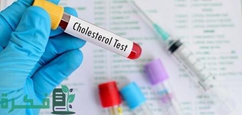 هل يشترط الصيام لتحليل الدهون 2 هل يشترط الصيام لتحليل الدهون