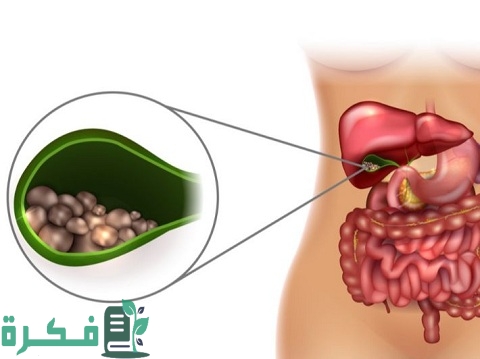 هل يمكن شرب القهوة بعد استئصال المرارة