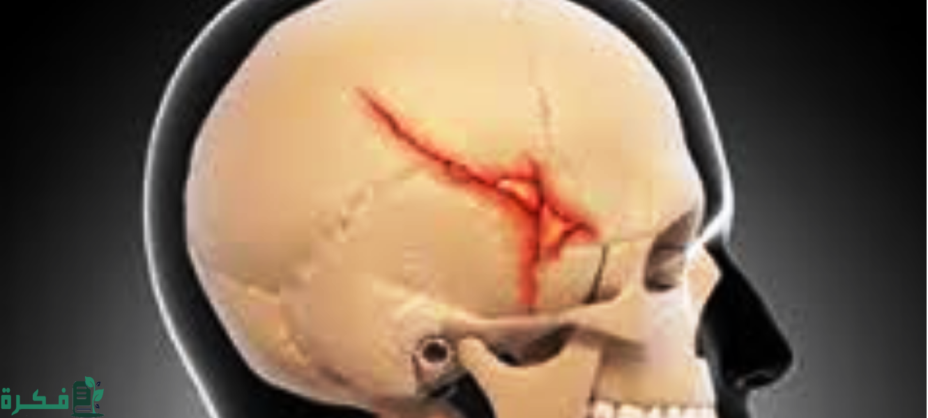 ما أسباب ألم عظام الجمجمة 10 مضاعفات ألم والتهابات عظام الجمجمة