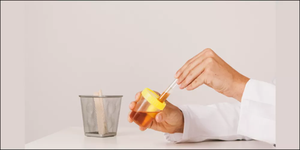 شرح خطوات حساب albumin/creatinine ratio 18 ما هو الألبومين