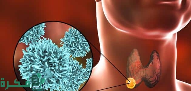 كم عدد جلسات الكيماوي لسرطان الغدد اللمفاوية 1 أشكال العلاج الكيماوي