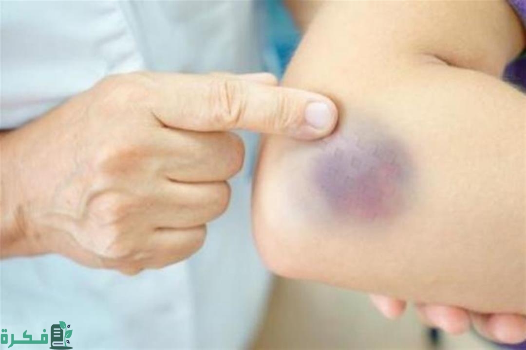 2021 11 18 13 23 50 741