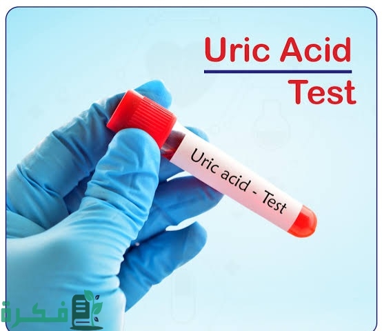 هل تحليل يوريك أسيد يحتاج صيام 2 images 2022 11 10T211743.773 1