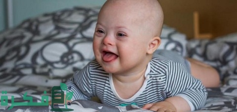 بحث عن متلازمة إدوارد