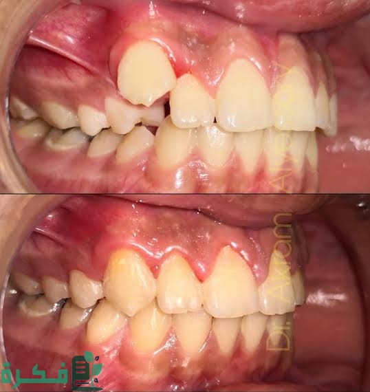 images 2022 12 02T215817.106