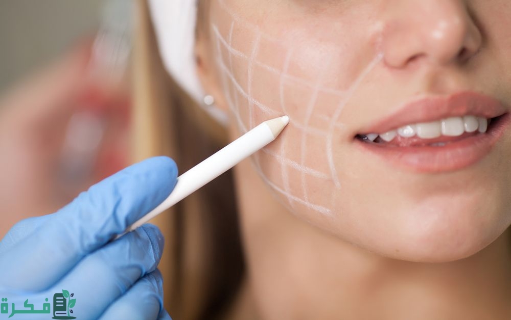 متى تذوب خيوط الغمازة 23 الاثار الجانبية لعملية الغمازات