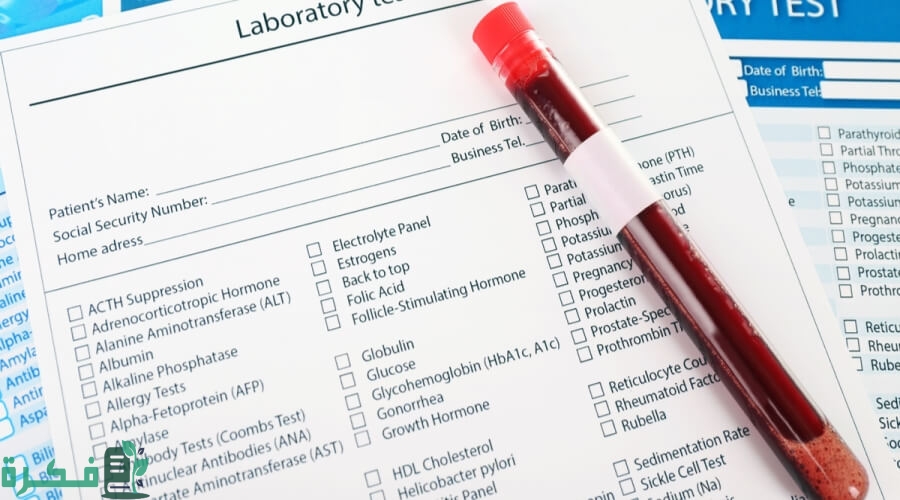 تجربتي مع تحليل المعادن