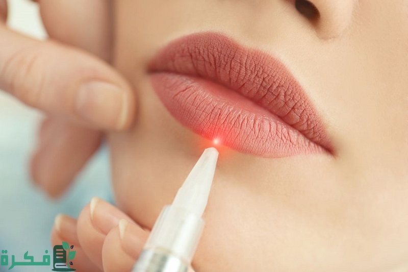 تجربتي مع توريد الشفايف بالليزر 4 تجربتي مع توريد الشفايف بالليزر