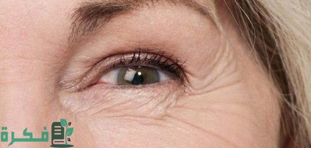 طرق إزالة التجاعيد تحت العين