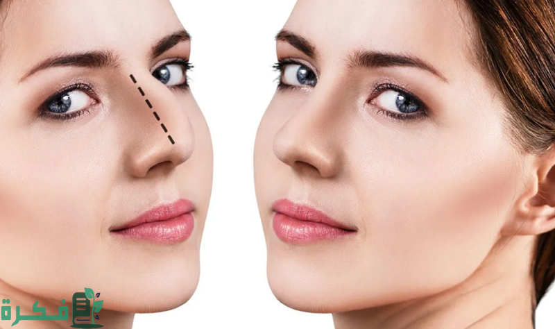 عملية تجميل الأنف جدة : افضل مراكز التجميل بجدة 2 عملية تجميل الأنف جدة