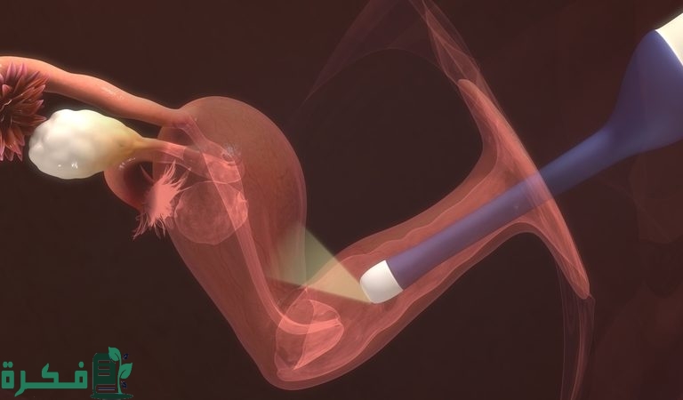 كيف تتم عملية ترجيع الاجنة