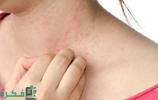 أفضل 5 أدوية لعلاج جفاف الجلد