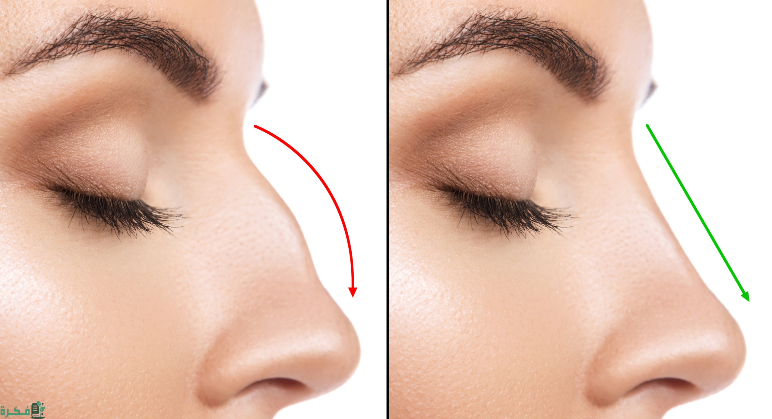 كم تكلف عملية تجميل الأنف