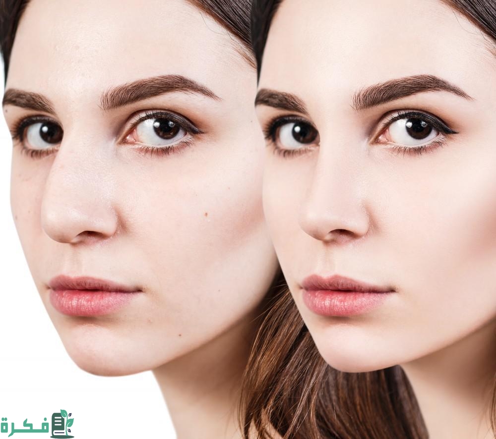 كم تكلفة عملية تجميل الأنف في مستشفى الحبيب