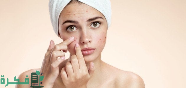 ماسك لحب الشباب سريع المفعول