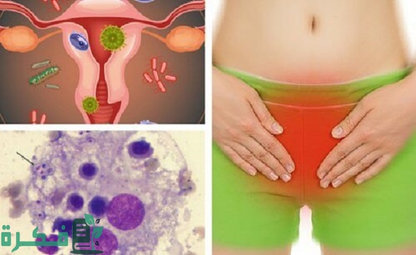 أسماء افضل 5 أنواع مضاد حيوي لالتهاب المهبل الفطري 21 أفضل 5 أنواع مضاد حيوي لالتهاب المهبل الفطري