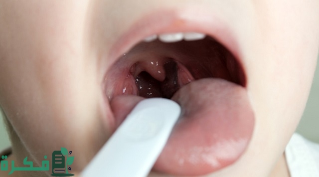 أسماء افضل 5 أنواع مضاد حيوي لعلاج التهاب اللوزتين للأطفال 18 أفضل 5 أنواع مضاد حيوي لعلاج التهاب اللوزتين للأطفال