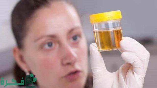 أسماء افضل 5 أنواع مضاد حيوي لعلاج صديد البول 49 أفضل 5 أنواع مضاد حيوي لعلاج صديد البول