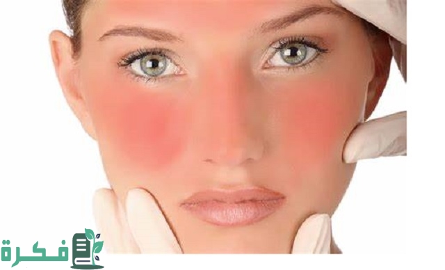 أفضل وصفة ماسك النشا لعلاج حروق الشمس