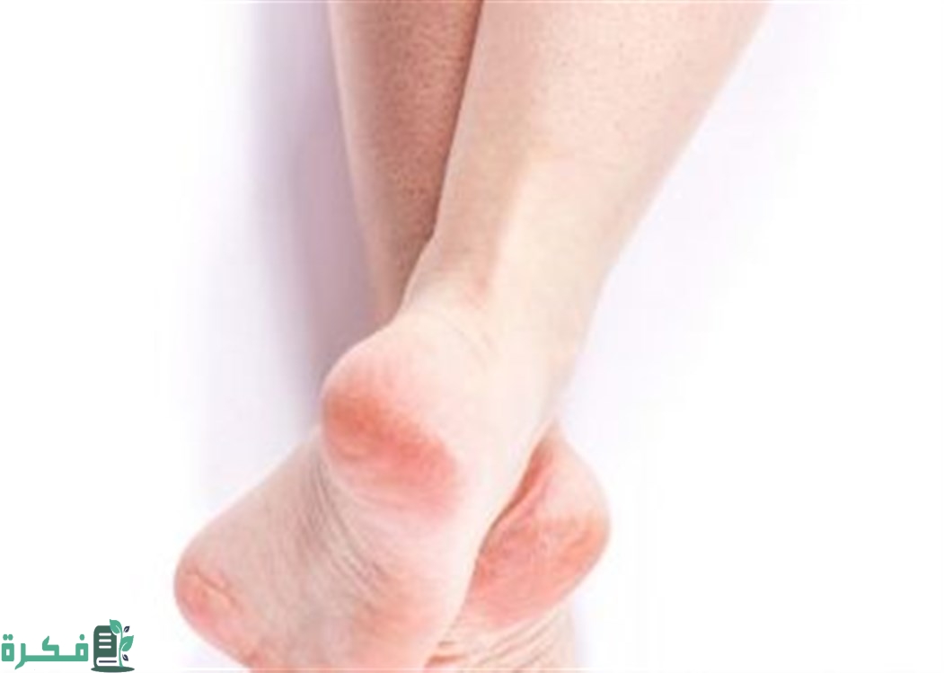 أشهر الكريمات الفعالة في تبييض القدمين