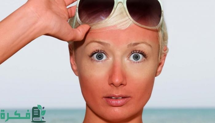 أنواع الكريمات بعد التعرض للشمس