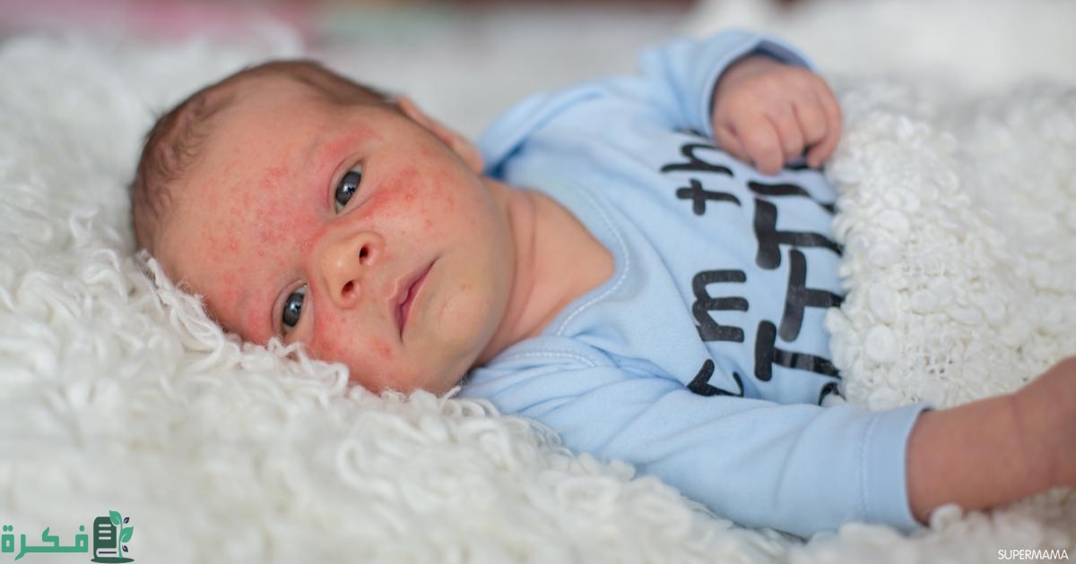 طريقة علاج كدمات الوجه للأطفال