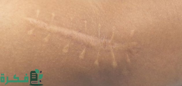 كيفية تكون الأنسجة