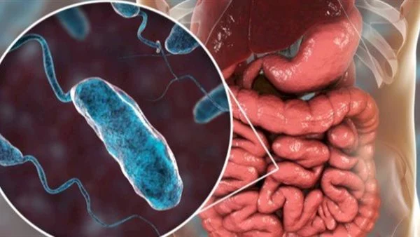 اذاعة عن مرض الكوليرا