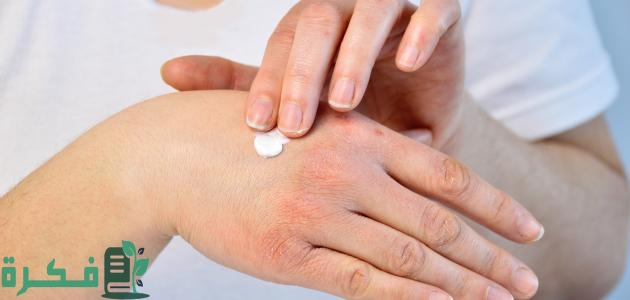 علاج حساسية الجلد من المنظفات