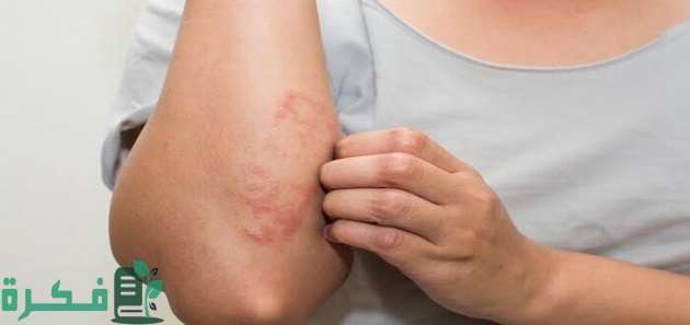 هل الجرب يعيش في الملابس