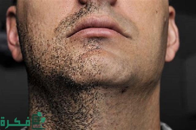 حل مشكلة عدم ظهور اللحية
