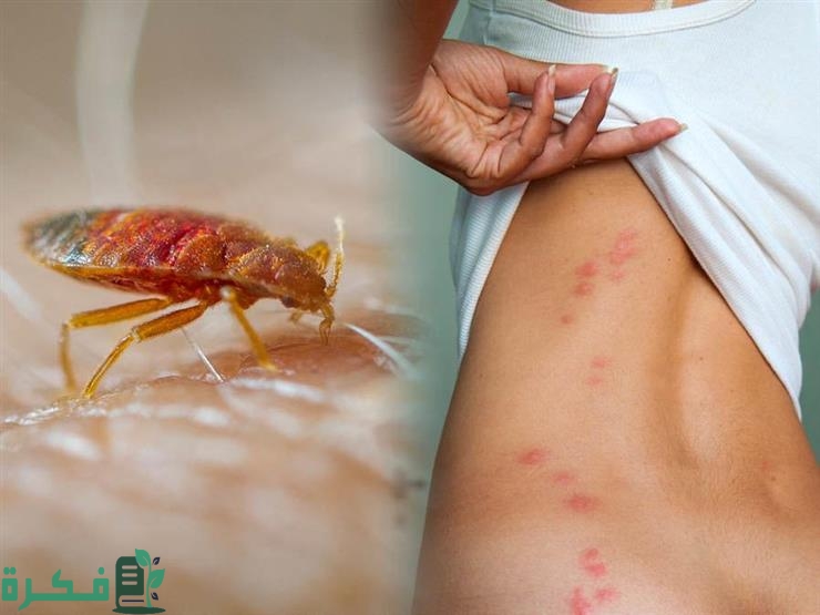 حل مشكلة بق الفراش