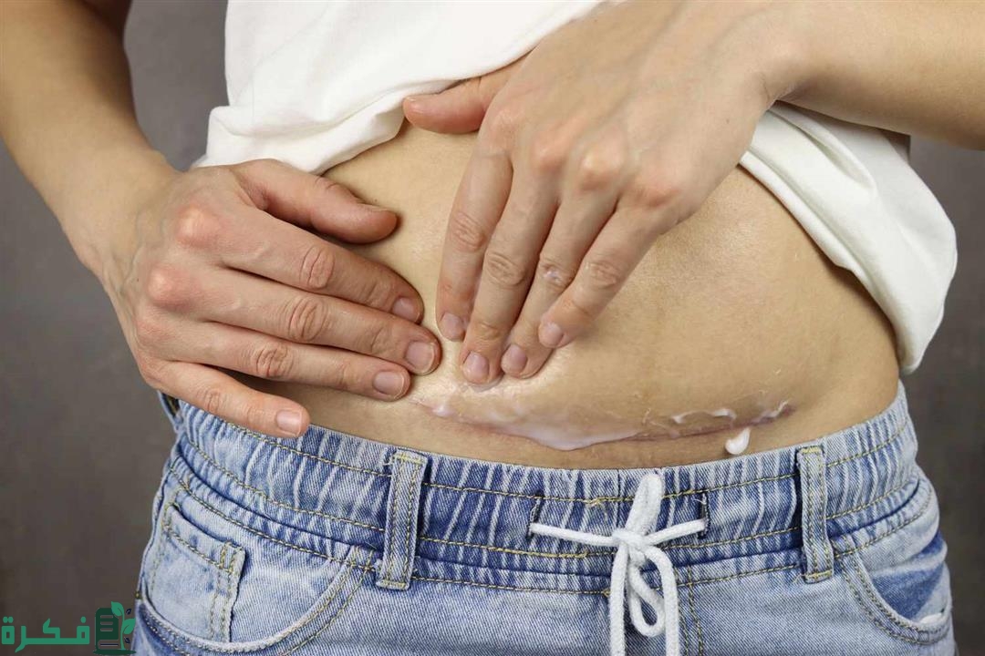 سلبيات وايجابيات الولادة القيصرية