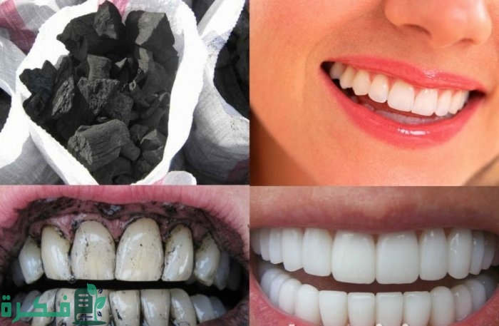 طريقة تبييض الأسنان بالفحم