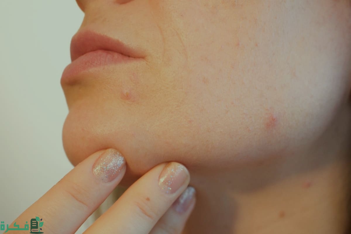 ظهور حبوب في الجسم أثناء الحمل وجنس الجنين