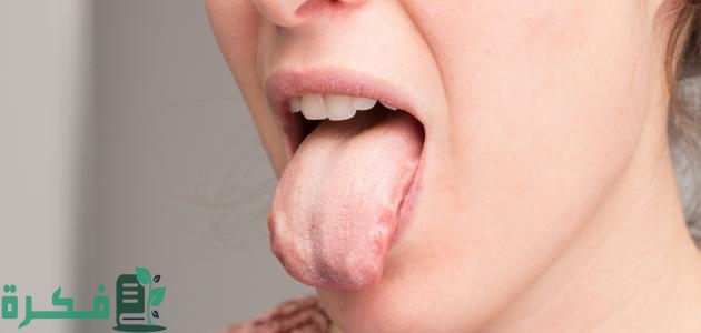 لون اللسان الطبيعي بالصور